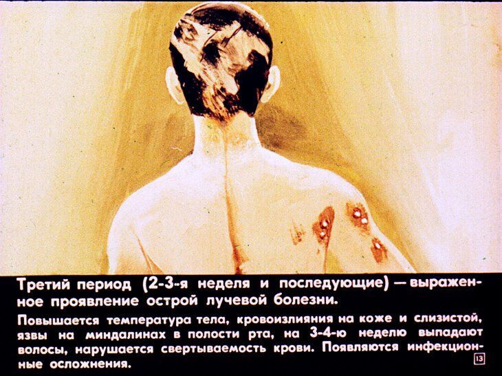 Первая медицинская помощь при радиационных и комбинированных поражениях. Диафильм СССР 1981